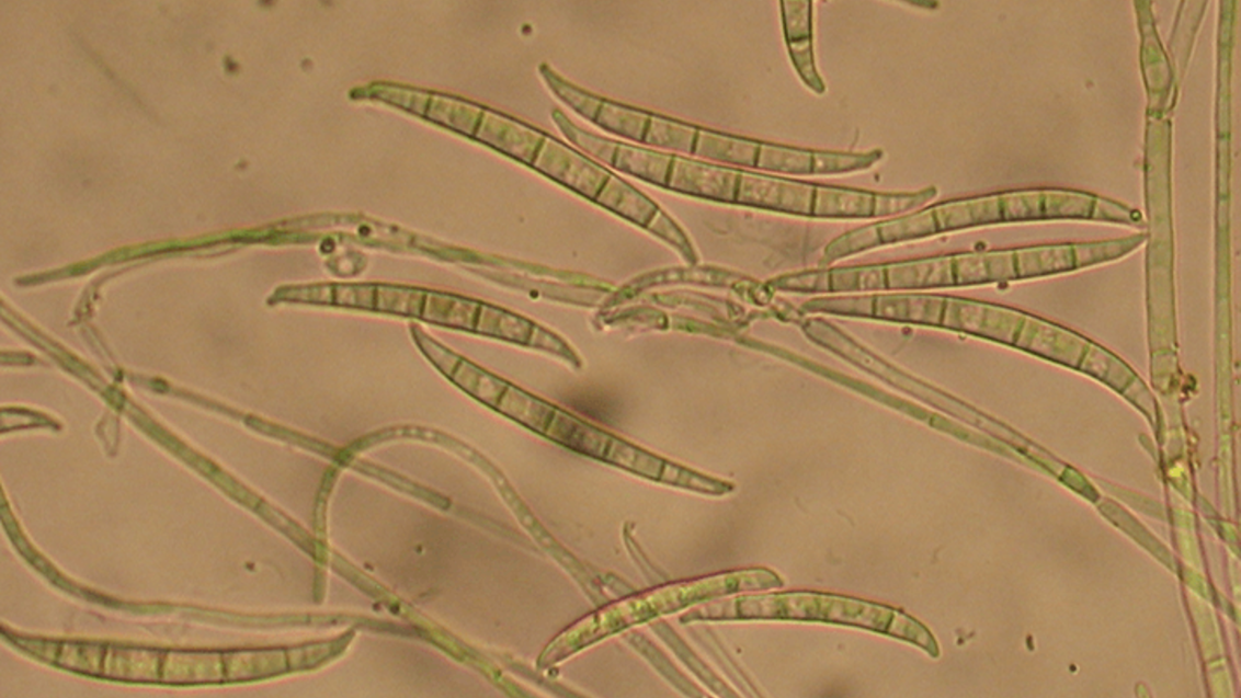 Fusarium graminearum. Фото из лаборатории «Сингенты» в Сколково