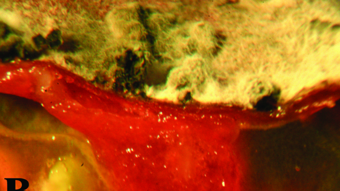 Продольный срез плода в области плодоножки (видно, что гриб неглубоко проникает в ткани плода)