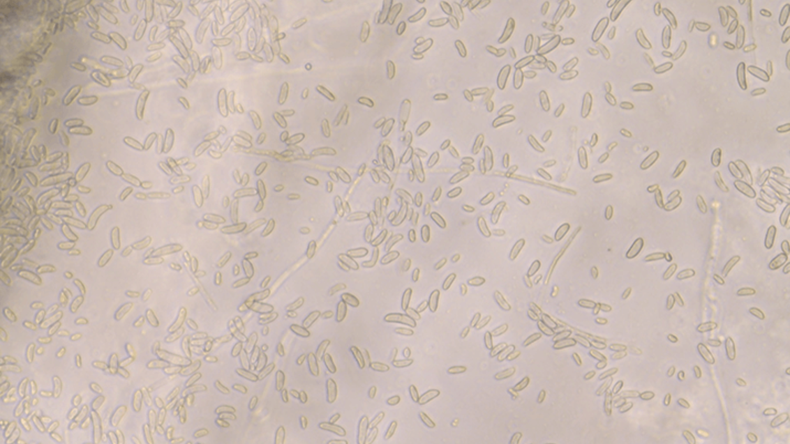 Fusarium sporotrichioides. Фото из лаборатории «Сингенты» в Сколково
