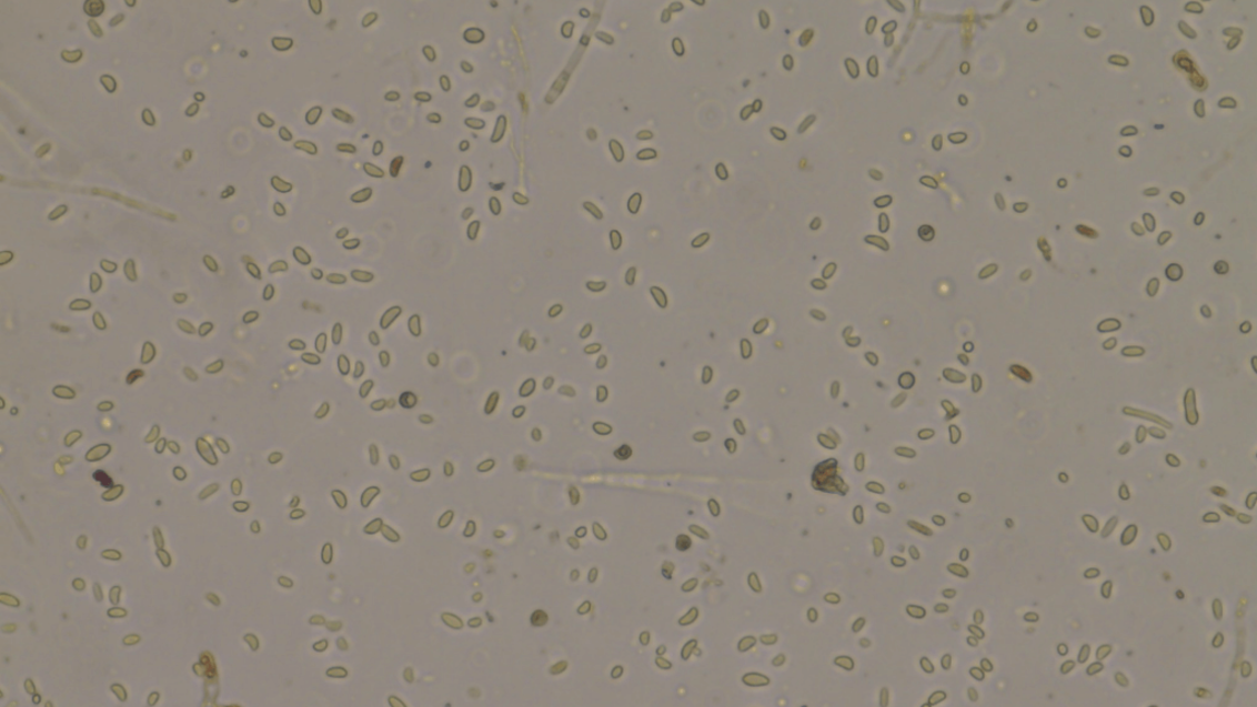 Verticillium spp. Фото из лаборатории «Сингенты» в Сколково 2018 
