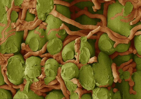 Мицелий бурой ржавчины в тканях листа через 5 дней после заражения