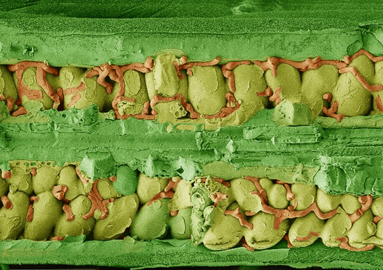 Мицелий бурой ржавчины в тканях листа через 8 дней после заражения