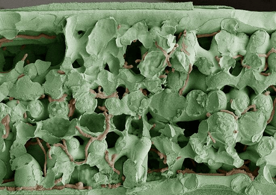 Мицелий септории в тканях листа через 30 дней после заражения
