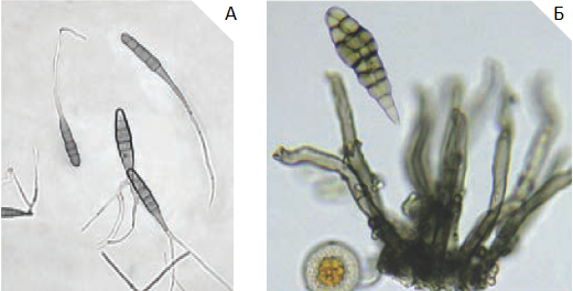 Альтернариоз (пурпурная пятнистость) лука