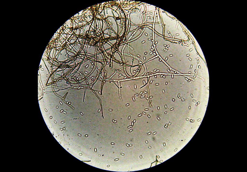 Пятнистый антракноз виноградной лозы (птичий глаз)