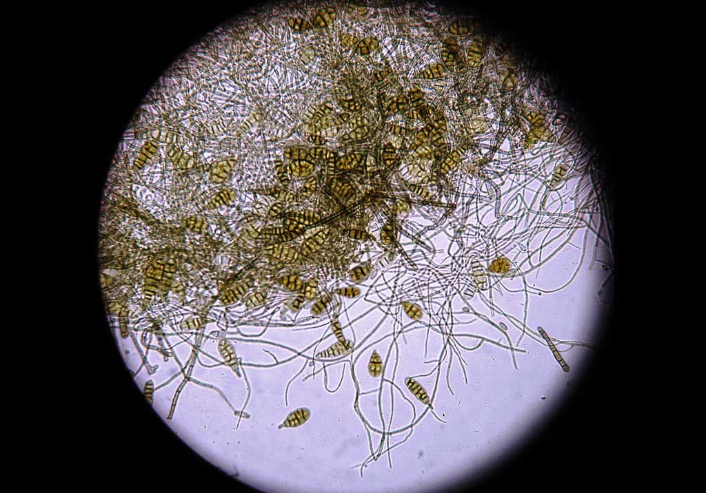 Альтернариоз винограда