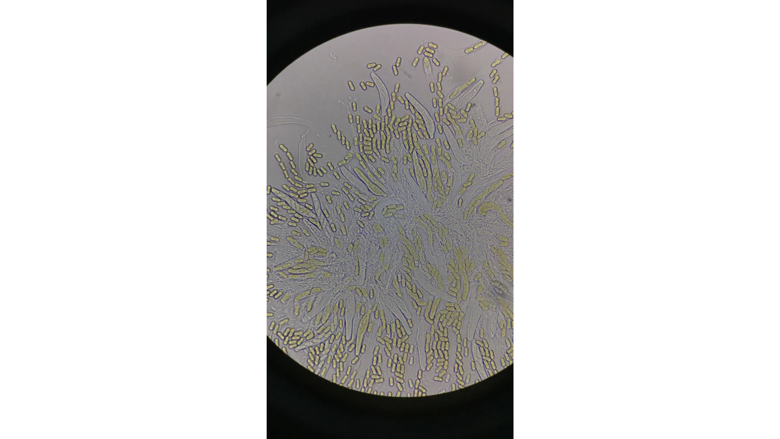 Парша яблони