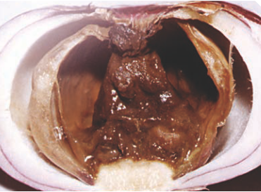 Мягкая или мокрая бактериальная гниль лука