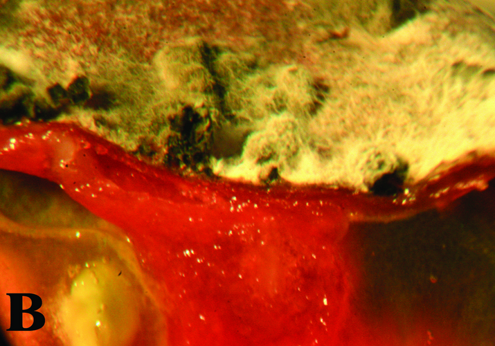 Головчатая плесень или мокрая ризопусная гниль плодов томата