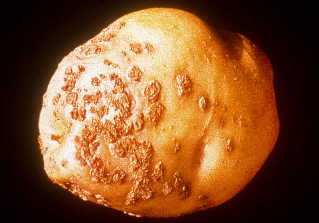 Парша порошистая