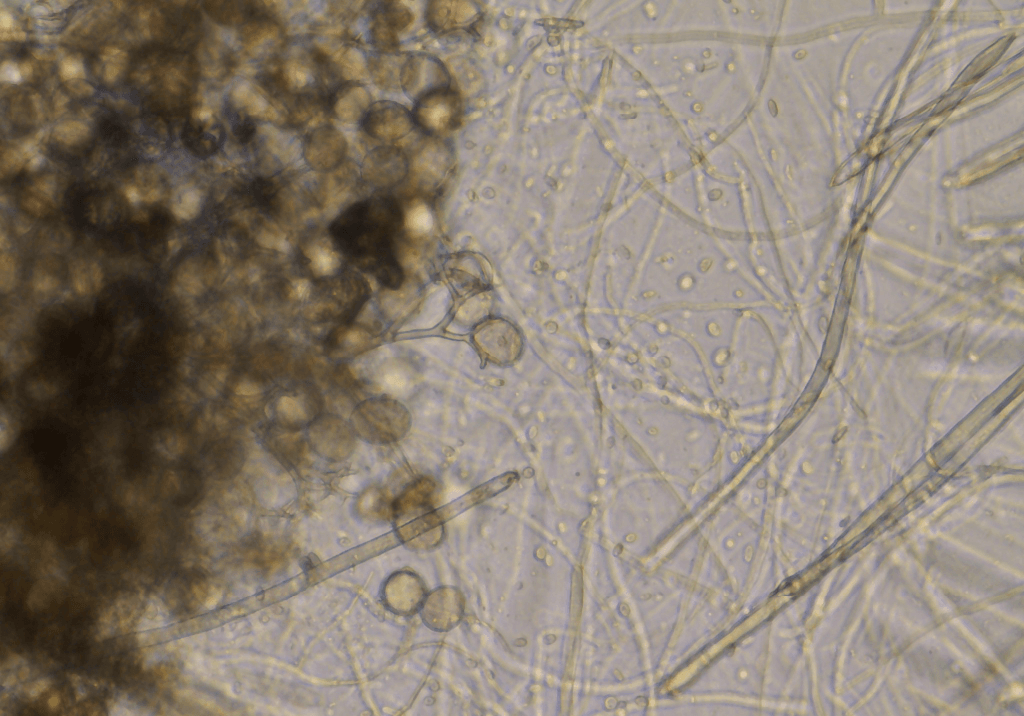 Милдью (ложная мучнистая роса винограда)