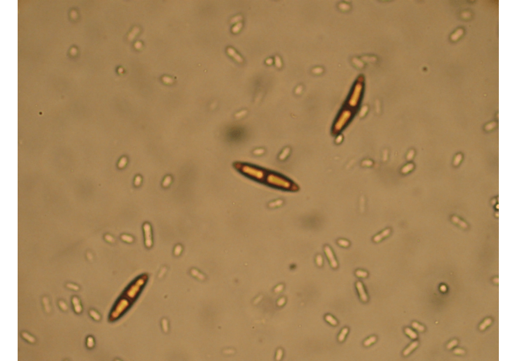 Гибеллиноз зерновых