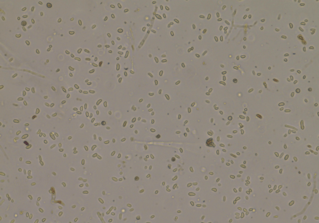 Вертициллёзное увядание томата