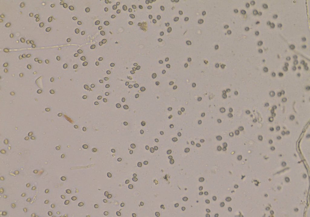 Головчатая плесень или мокрая ризопусная гниль плодов томата