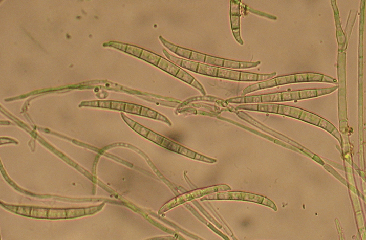 Фузариозная корневая и прикорневая гниль