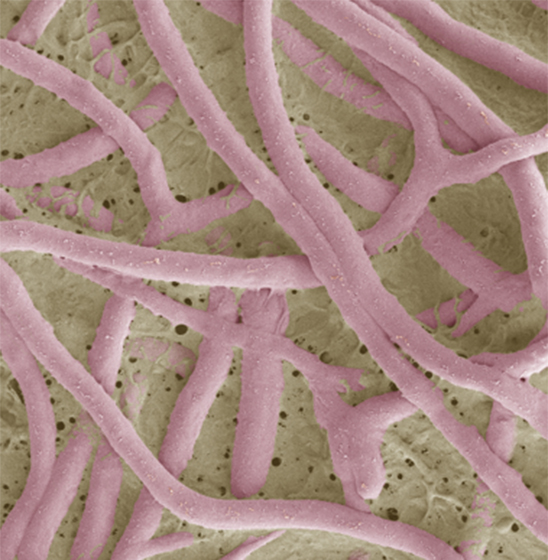 Без обработки (35 дней после заражения)