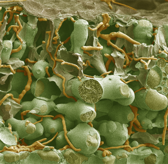 Без обработки (35 дней после заражения)